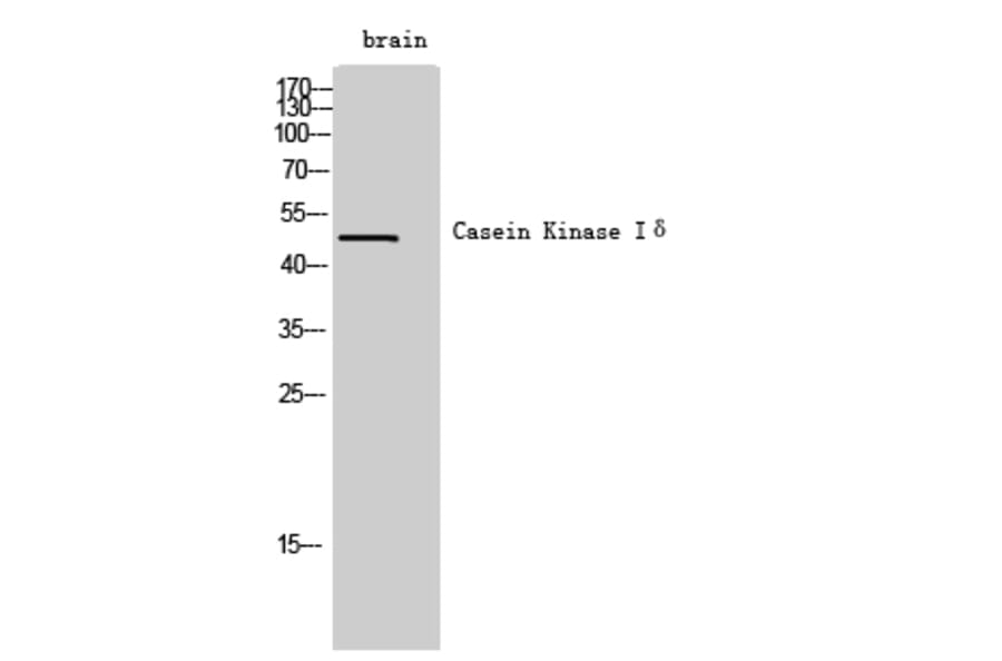 Western Blot - Anti-CSNK1D Antibody (C21126) - Antibodies.com