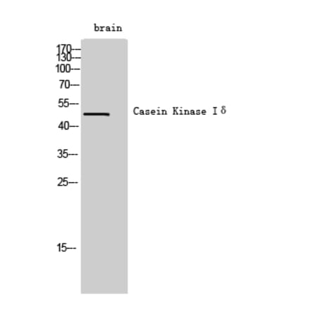 Western Blot - Anti-CSNK1D Antibody (C21126) - Antibodies.com