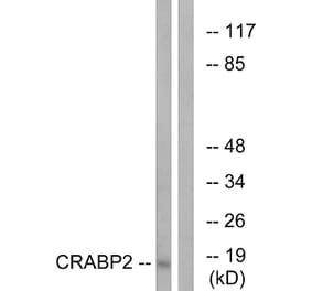 Western Blot - Anti-CRABP2 Antibody (C15032) - Antibodies.com
