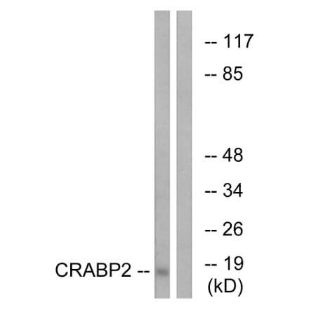 Western Blot - Anti-CRABP2 Antibody (C15032) - Antibodies.com