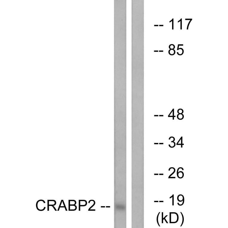 Western Blot - Anti-CRABP2 Antibody (C15032) - Antibodies.com