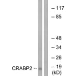 Western Blot - Anti-CRABP2 Antibody (C15032) - Antibodies.com