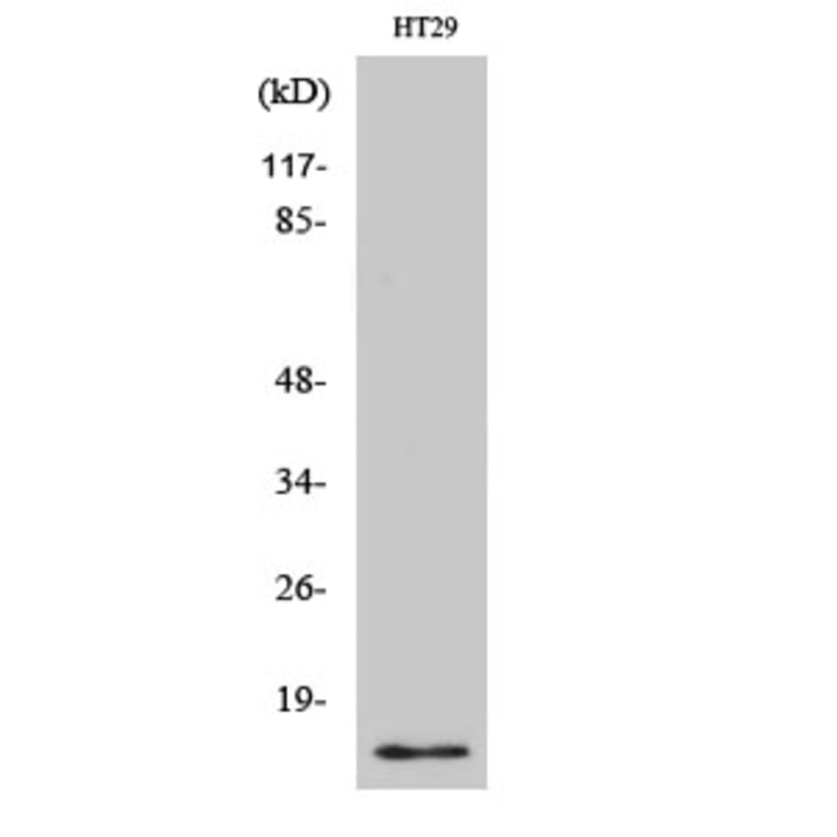 Western Blot - Anti-CRABP2 Antibody (C15032) - Antibodies.com