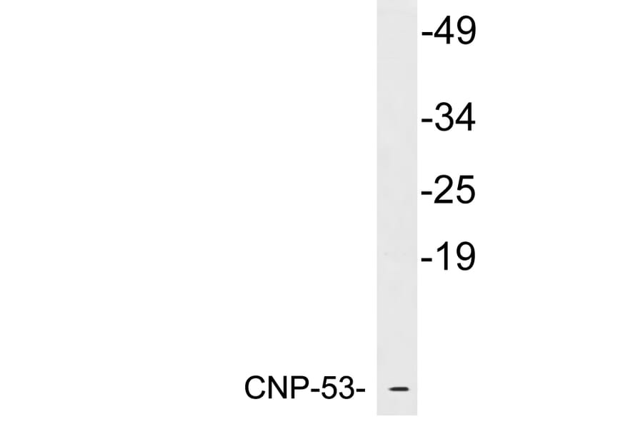 Western Blot - Anti-CNP-53 Antibody (R12-2095) - Antibodies.com