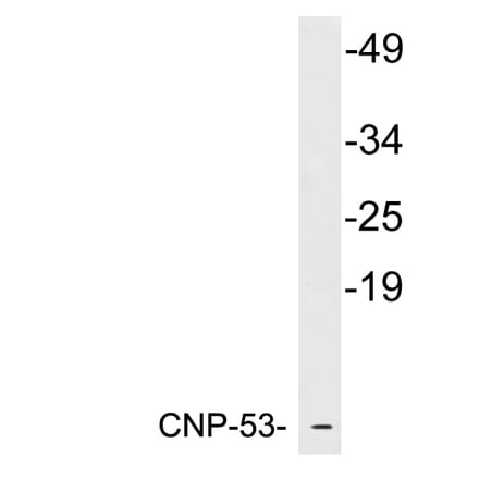 Western Blot - Anti-CNP-53 Antibody (R12-2095) - Antibodies.com