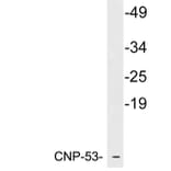 Western Blot - Anti-CNP-53 Antibody (R12-2095) - Antibodies.com