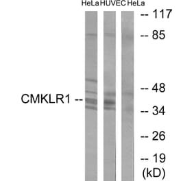 Western Blot - Anti-CMKLR1 Antibody (C12193) - Antibodies.com