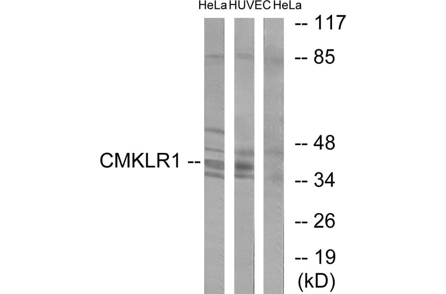 Western Blot - Anti-CMKLR1 Antibody (C12193) - Antibodies.com