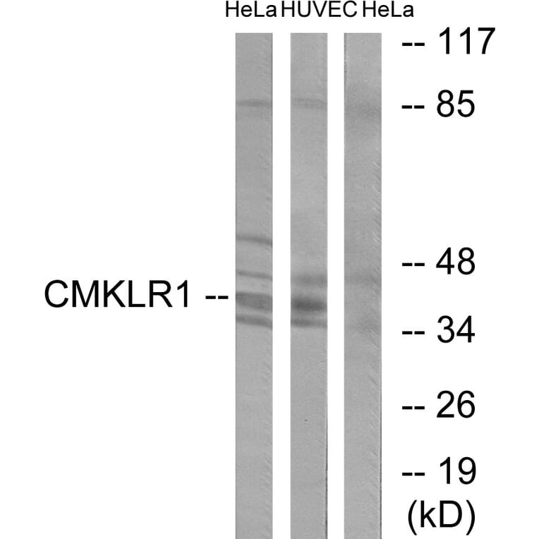 Western Blot - Anti-CMKLR1 Antibody (C12193) - Antibodies.com