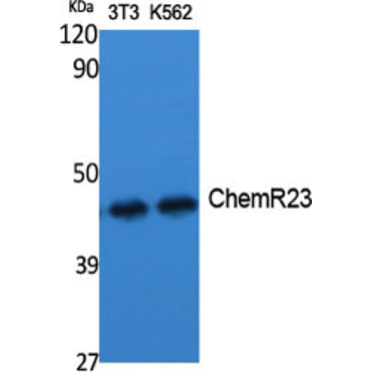 Western Blot - Anti-CMKLR1 Antibody (C12193) - Antibodies.com
