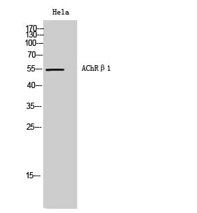Western blot analysis of Hela cells using Anti-CHRNB1 Antibody.