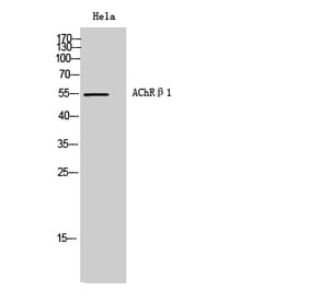 Western Blot - Anti-CHRNB1 Antibody (C14225) - Antibodies.com
