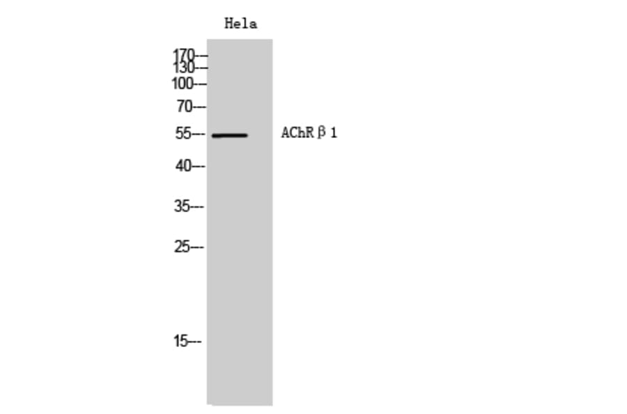 Western Blot - Anti-CHRNB1 Antibody (C14225) - Antibodies.com