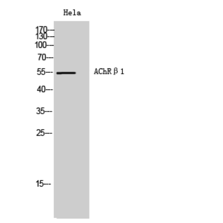 Western Blot - Anti-CHRNB1 Antibody (C14225) - Antibodies.com