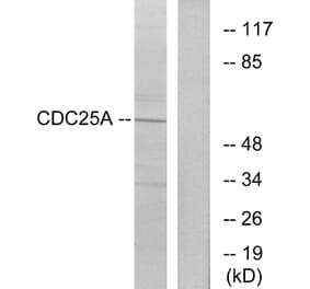 Western Blot - Anti-CDC25A Antibody (B7037) - Antibodies.com