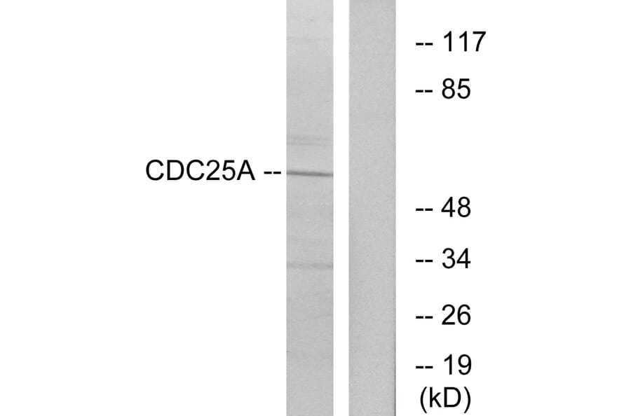 Western Blot - Anti-CDC25A Antibody (B7037) - Antibodies.com