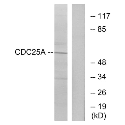 Western Blot - Anti-CDC25A Antibody (B7037) - Antibodies.com
