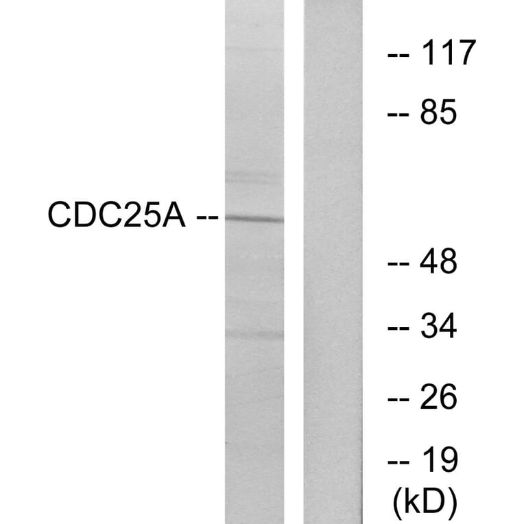 Western Blot - Anti-CDC25A Antibody (B7037) - Antibodies.com
