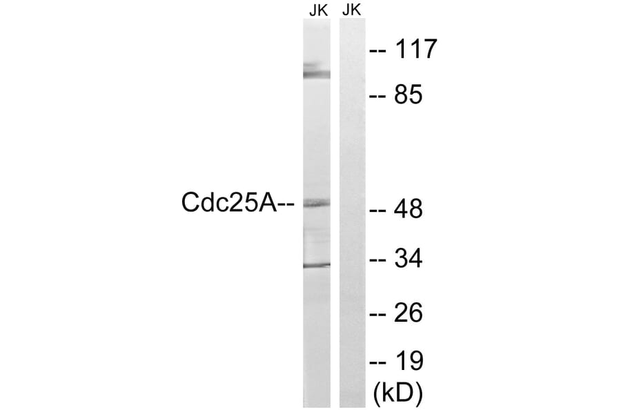 Western Blot - Anti-CDC25A Antibody (B8017) - Antibodies.com