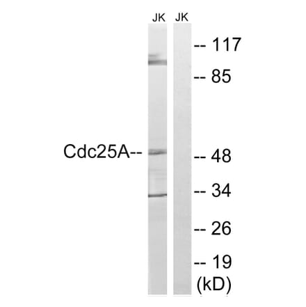 Western Blot - Anti-CDC25A Antibody (B8017) - Antibodies.com