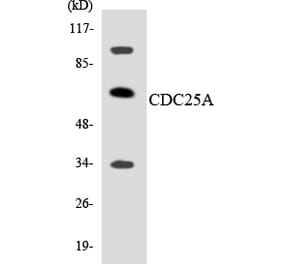 Western Blot - Anti-CDC25A Antibody (R12-2596) - Antibodies.com