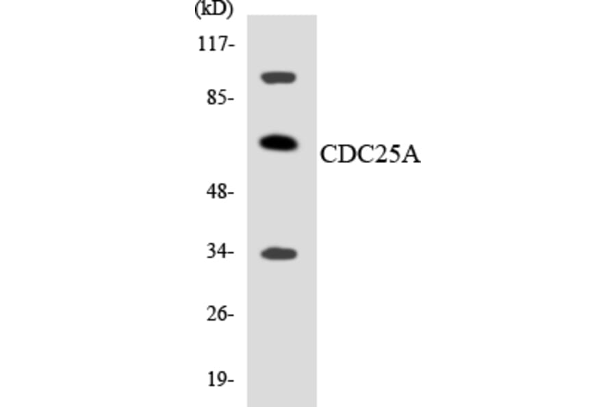Western Blot - Anti-CDC25A Antibody (R12-2596) - Antibodies.com