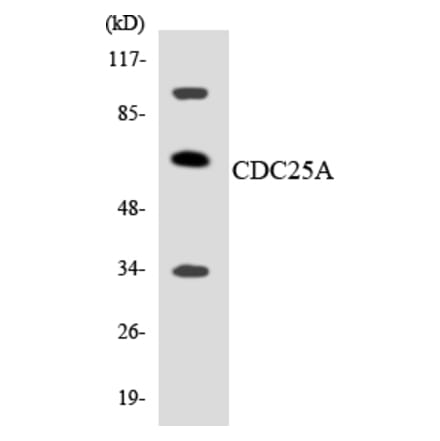 Western Blot - Anti-CDC25A Antibody (R12-2596) - Antibodies.com