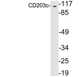 Western Blot - Anti-CD203c Antibody (R12-2068) - Antibodies.com