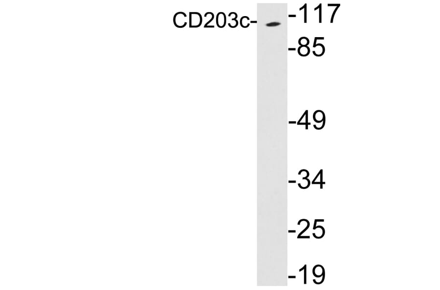 Western Blot - Anti-CD203c Antibody (R12-2068) - Antibodies.com