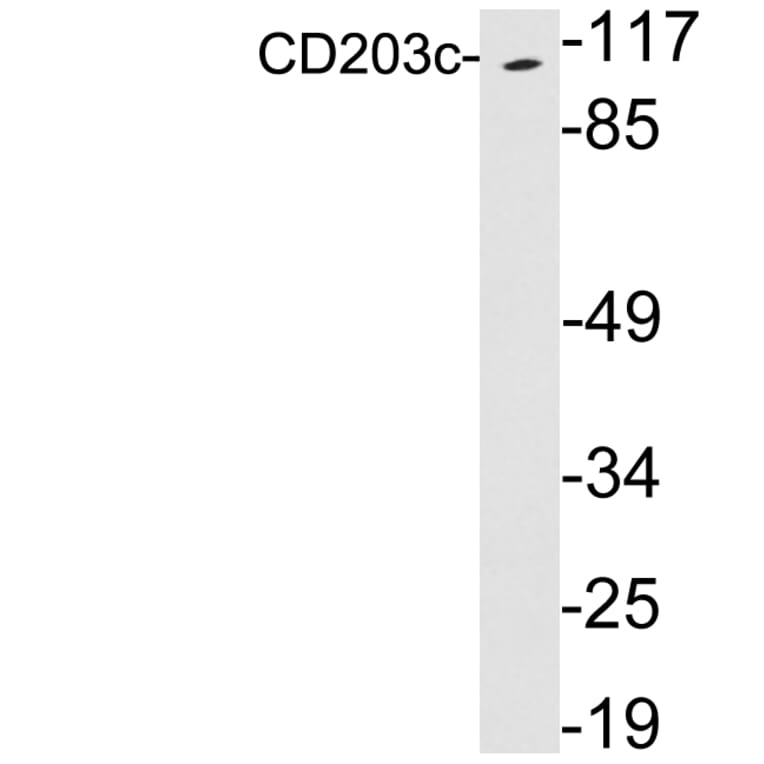 Western Blot - Anti-CD203c Antibody (R12-2068) - Antibodies.com