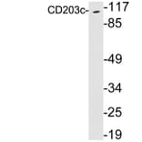 Western Blot - Anti-CD203c Antibody (R12-2068) - Antibodies.com