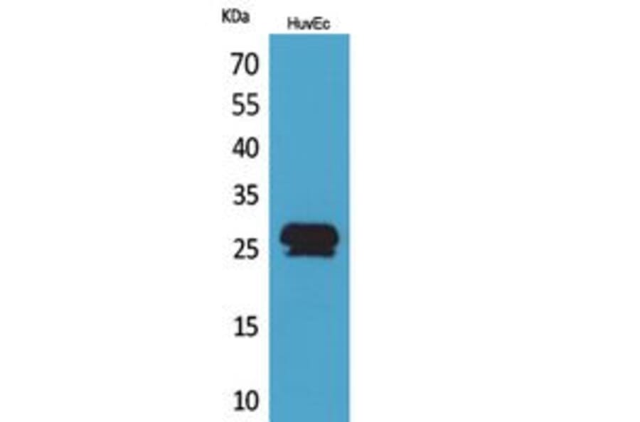 Western Blot - Anti-CACYBP Antibody (C30282) - Antibodies.com