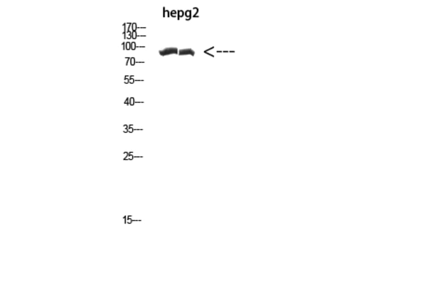 Western Blot - Anti-CACTIN Antibody (C31011) - Antibodies.com