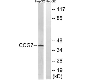 Western Blot - Anti-CACNG7 Antibody (C19525) - Antibodies.com