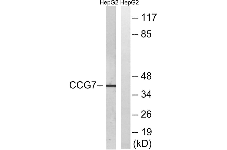 Western Blot - Anti-CACNG7 Antibody (C19525) - Antibodies.com