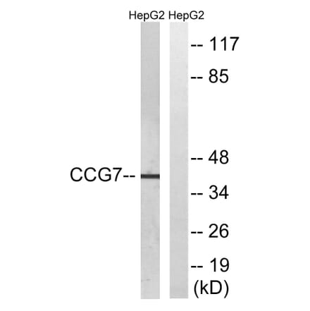 Western Blot - Anti-CACNG7 Antibody (C19525) - Antibodies.com