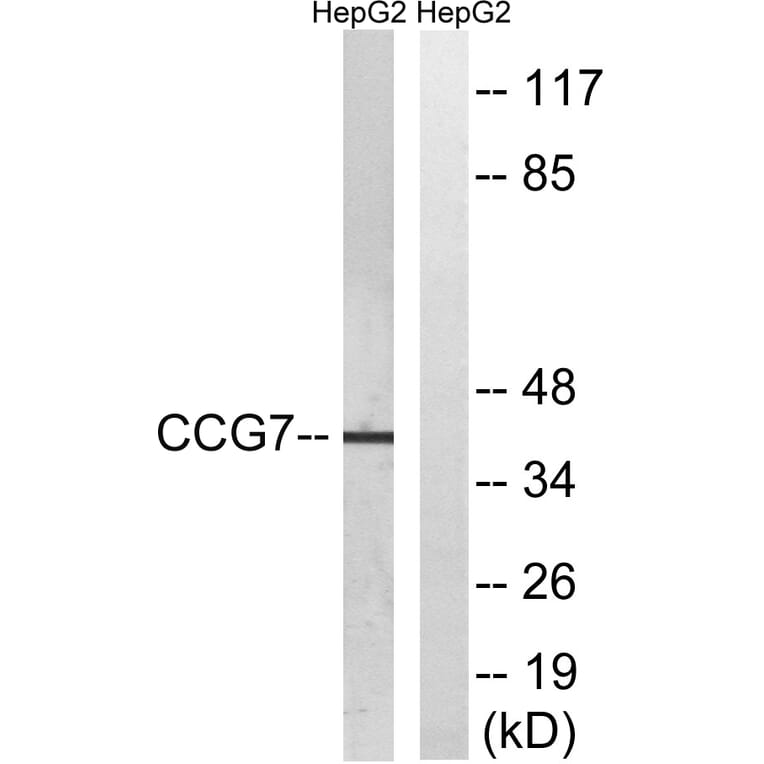 Western Blot - Anti-CACNG7 Antibody (C19525) - Antibodies.com