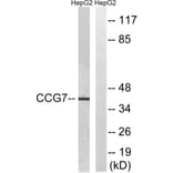 Western Blot - Anti-CACNG7 Antibody (C19525) - Antibodies.com
