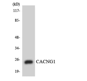 Western Blot - Anti-CACNG1 Antibody (R12-2562) - Antibodies.com