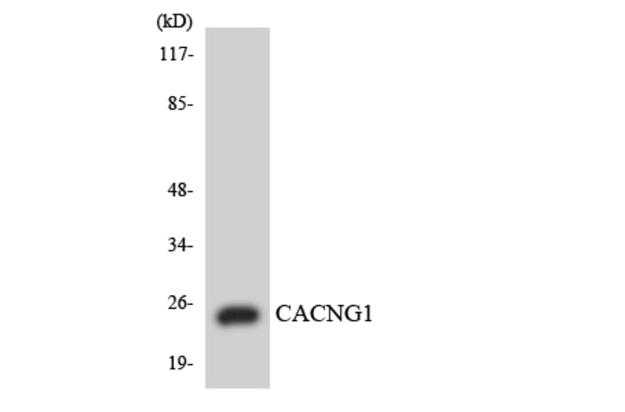 Western Blot - Anti-CACNG1 Antibody (R12-2562) - Antibodies.com
