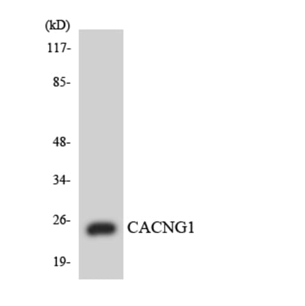 Western Blot - Anti-CACNG1 Antibody (R12-2562) - Antibodies.com