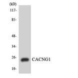 Western Blot - Anti-CACNG1 Antibody (R12-2562) - Antibodies.com