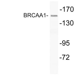 Western Blot - Anti-BRCAA1 Antibody (R12-2043) - Antibodies.com