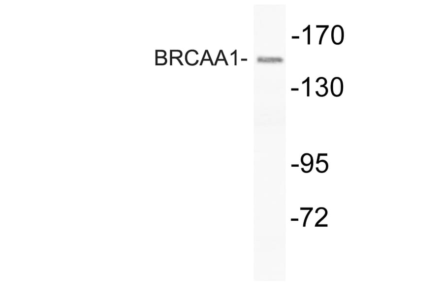 Western Blot - Anti-BRCAA1 Antibody (R12-2043) - Antibodies.com