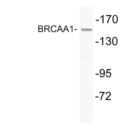Western Blot - Anti-BRCAA1 Antibody (R12-2043) - Antibodies.com
