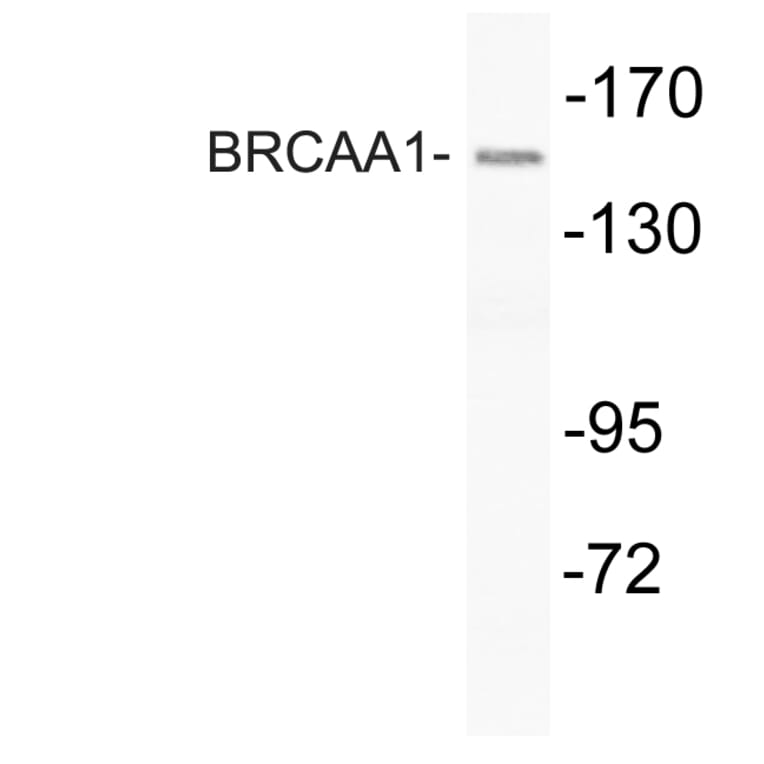 Western Blot - Anti-BRCAA1 Antibody (R12-2043) - Antibodies.com