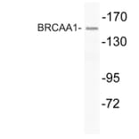 Western Blot - Anti-BRCAA1 Antibody (R12-2043) - Antibodies.com