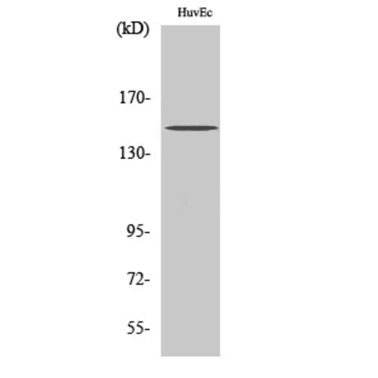 Western Blot - Anti-BRCAA1 Antibody (R12-2043) - Antibodies.com