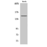 Western Blot - Anti-BRCAA1 Antibody (R12-2043) - Antibodies.com