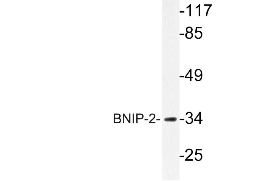 Western Blot - Anti-BNIP-2 Antibody (R12-2041) - Antibodies.com